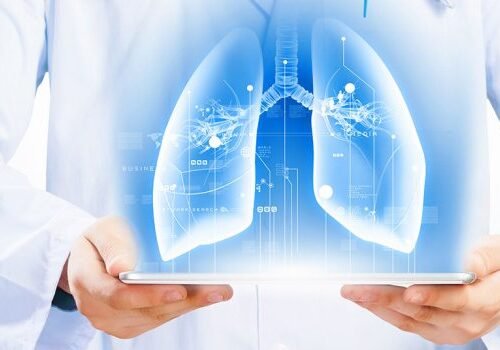 Best-Respiratory-Medicine-Treatment-In-Chembur-800x350 Pulmonology, Critical Care & Sleep Medicine