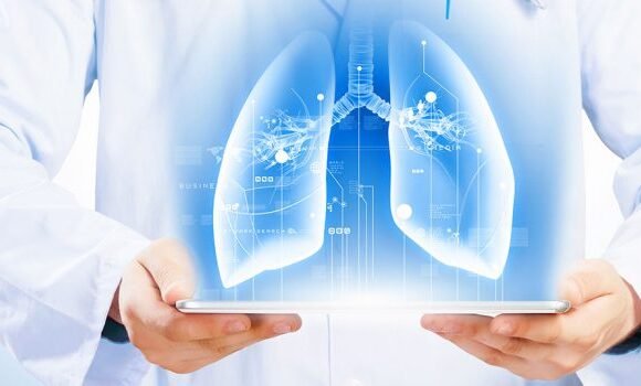 Best-Respiratory-Medicine-Treatment-In-Chembur-800x350 Pulmonology, Critical Care & Sleep Medicine